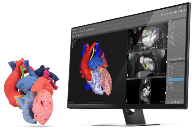 3D Tıbbi Görüntü Segmentasyon Yazılımı